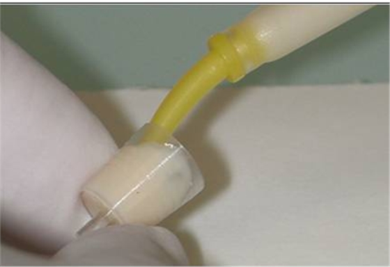 后牙烤瓷橋備牙全過程 后牙烤瓷橋備牙全過程