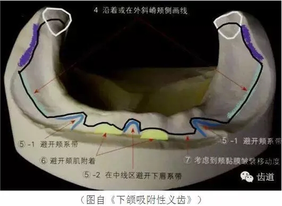 QQ圖片20150710153404.png QQ圖片20150710153404.png