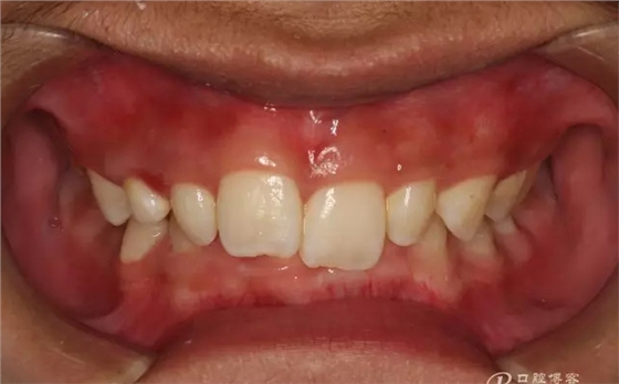 QQ圖片20150710153311.png QQ圖片20150710153311.png