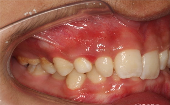 QQ圖片20150710153724.png QQ圖片20150710153724.png