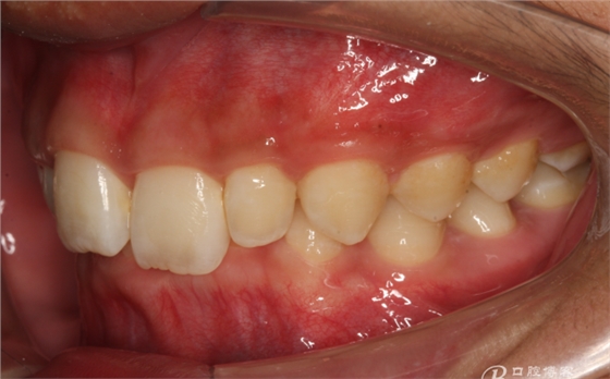 QQ圖片20150710153828.png QQ圖片20150710153828.png