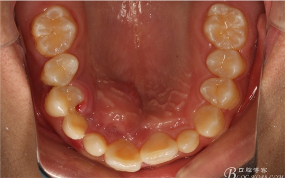 QQ圖片20150710153925.png QQ圖片20150710153925.png