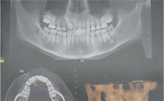 QQ圖片20150710154106.png QQ圖片20150710154106.png