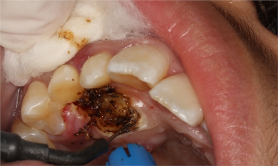 QQ圖片20150710154356.png QQ圖片20150710154356.png