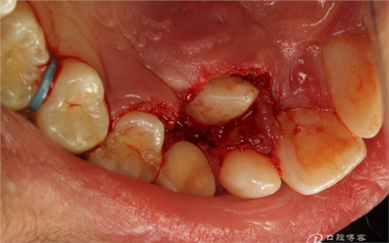 QQ圖片20150710154452.png QQ圖片20150710154452.png