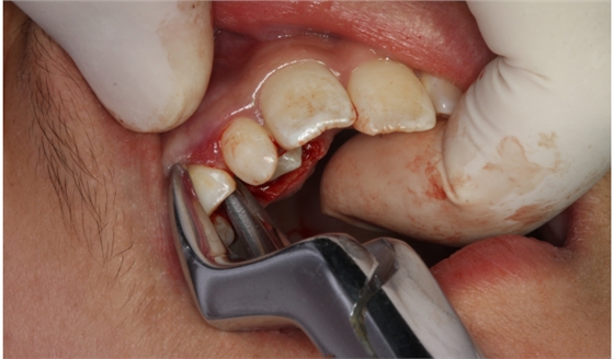 QQ圖片20150710154541.png QQ圖片20150710154541.png