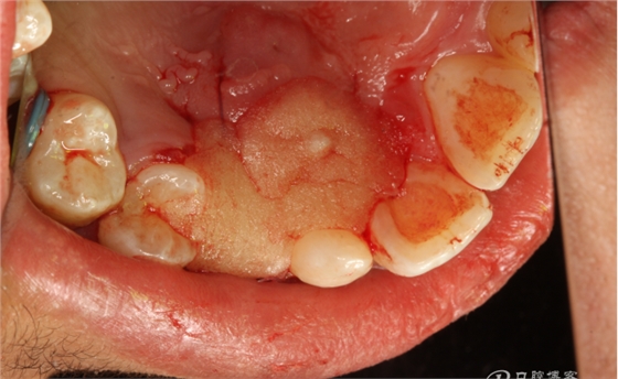 QQ圖片20150710154731.png QQ圖片20150710154731.png