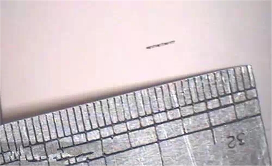 根管治療中斷針及處理方法