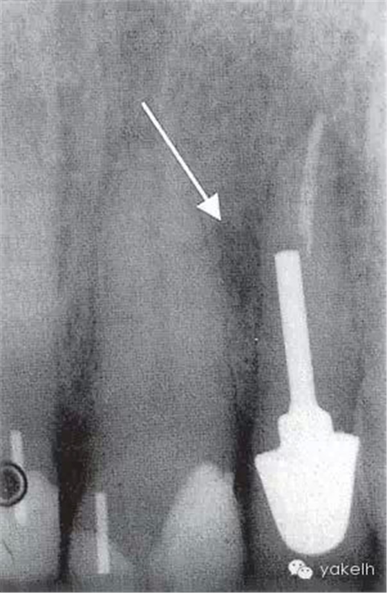 QQ圖片20150711144130.png QQ圖片20150711144130.png