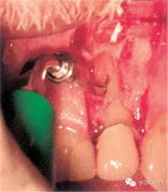 QQ圖片20150711144506.png QQ圖片20150711144506.png