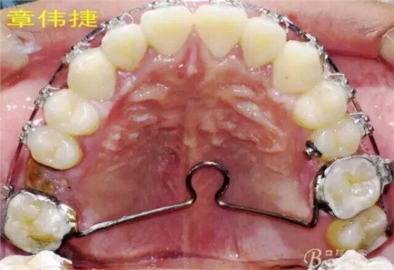 QQ圖片20150711161434.jpg QQ圖片20150711161434.jpg