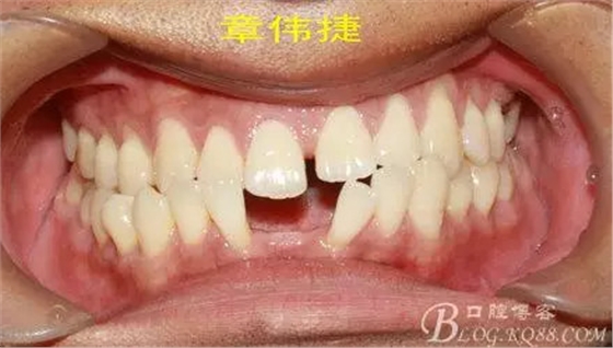 QQ圖片20150711161830.png QQ圖片20150711161830.png