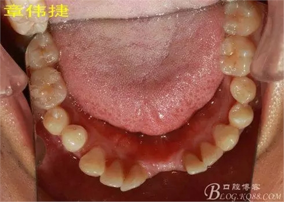 QQ圖片20150711161915.png QQ圖片20150711161915.png