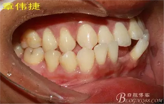 QQ圖片20150711161939.png QQ圖片20150711161939.png