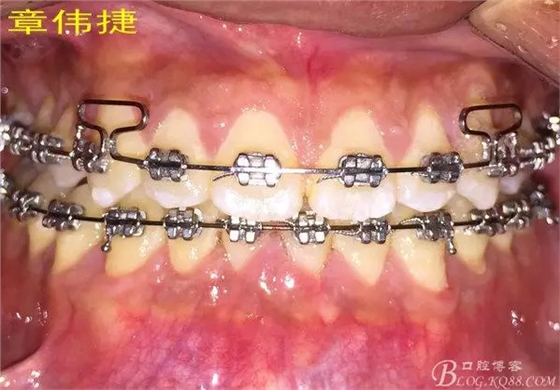 QQ圖片20150711162216.png QQ圖片20150711162216.png