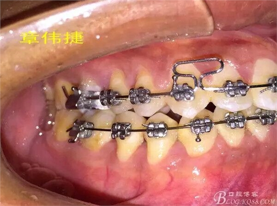 QQ圖片20150711162233.jpg QQ圖片20150711162233.jpg