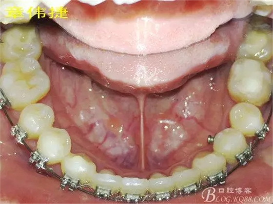 QQ圖片20150711162330.png QQ圖片20150711162330.png