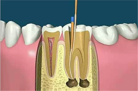 QQ圖片20150712113205.png QQ圖片20150712113205.png