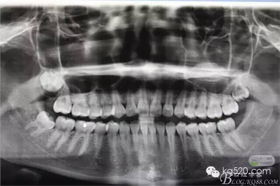 QQ圖片20150712143204.jpg QQ圖片20150712143204.jpg