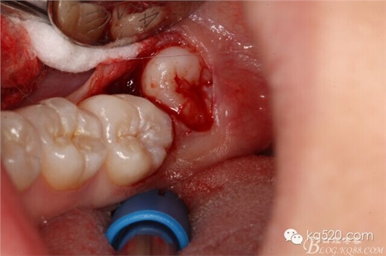 QQ圖片20150712143453.jpg QQ圖片20150712143453.jpg