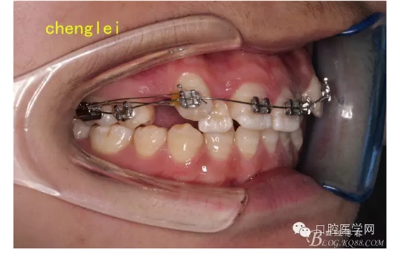 QQ圖片20150717171744.png QQ圖片20150717171744.png