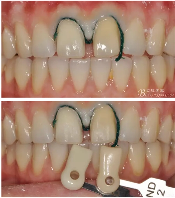 QQ圖片20150718114257.png QQ圖片20150718114257.png