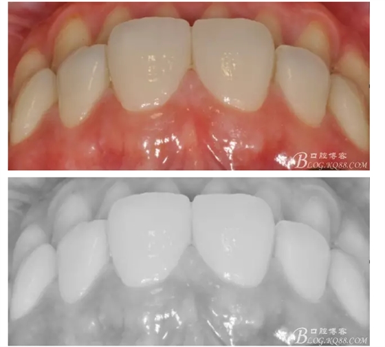 QQ圖片20150718114410.png QQ圖片20150718114410.png