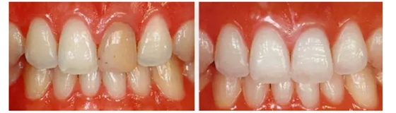 QQ圖片20150718165147.png QQ圖片20150718165147.png