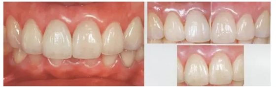 QQ圖片20150718165252.png QQ圖片20150718165252.png