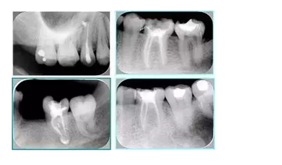 QQ圖片20150720110720.png QQ圖片20150720110720.png