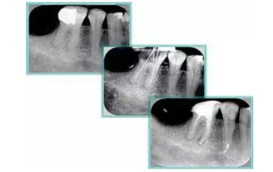 QQ圖片20150720110935.png QQ圖片20150720110935.png