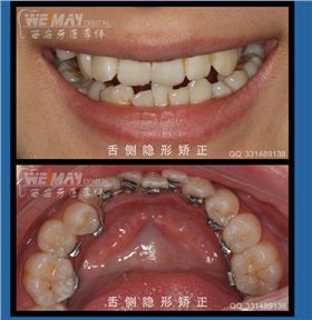 QQ圖片20150720154525.png QQ圖片20150720154525.png