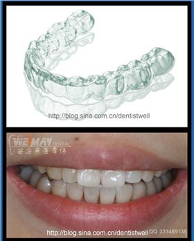 QQ圖片20150720154538.png QQ圖片20150720154538.png