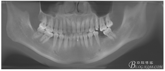 QQ圖片20150721091349.png QQ圖片20150721091349.png