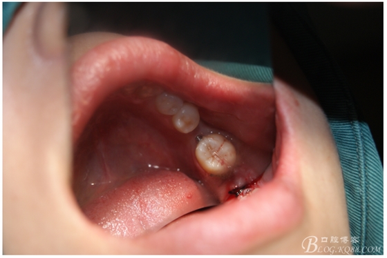 QQ圖片20150721091606.png QQ圖片20150721091606.png