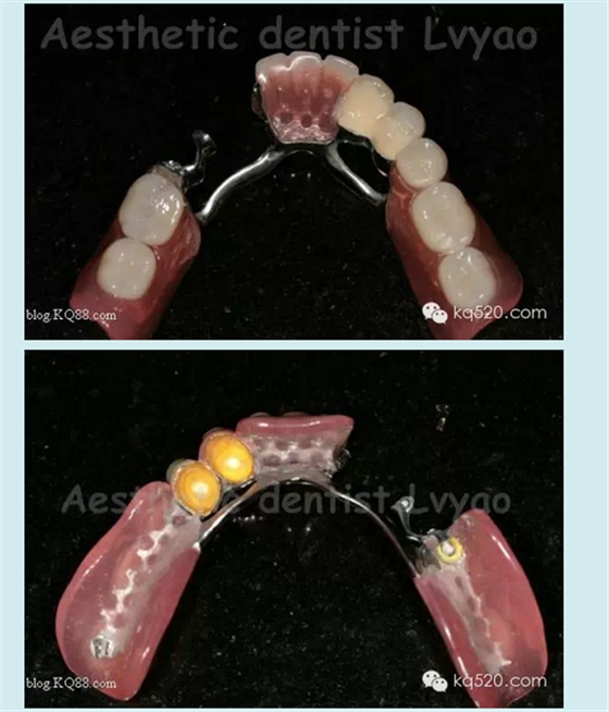 QQ圖片20150721152519.png QQ圖片20150721152519.png