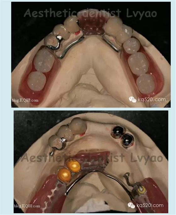 QQ圖片20150721152500.png QQ圖片20150721152500.png