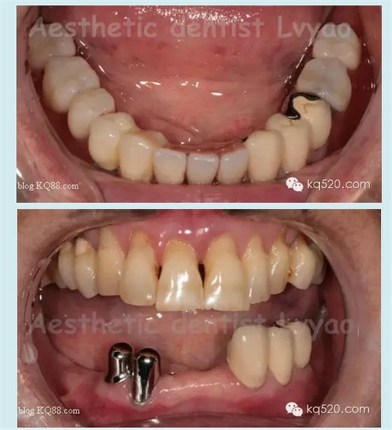 QQ圖片20150721152446.png QQ圖片20150721152446.png