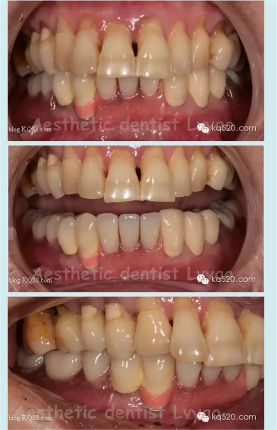 QQ圖片20150721152429.png QQ圖片20150721152429.png