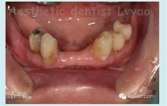 QQ圖片20150721152403.png QQ圖片20150721152403.png