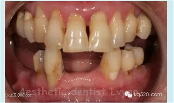 QQ圖片20150721152336.png QQ圖片20150721152336.png