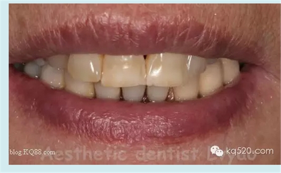 QQ圖片20150721152314.png QQ圖片20150721152314.png