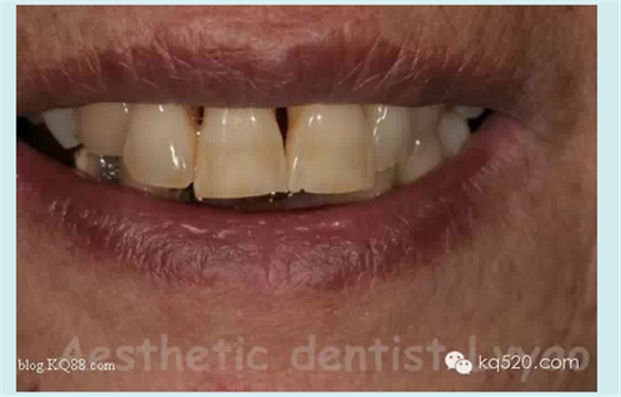 QQ圖片20150721152257.png QQ圖片20150721152257.png