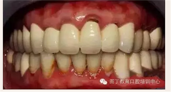 QQ圖片20150724141407.png QQ圖片20150724141407.png