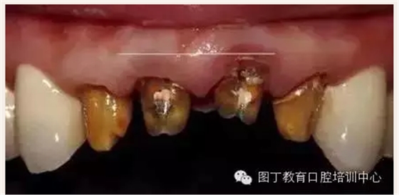 QQ圖片20150724141420.png QQ圖片20150724141420.png