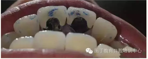 QQ圖片20150724141450.png QQ圖片20150724141450.png