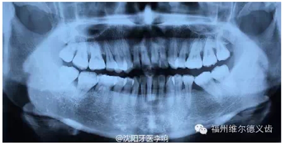 QQ圖片20150725100309.png QQ圖片20150725100309.png