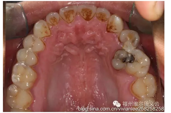 QQ圖片20150725100321.png QQ圖片20150725100321.png