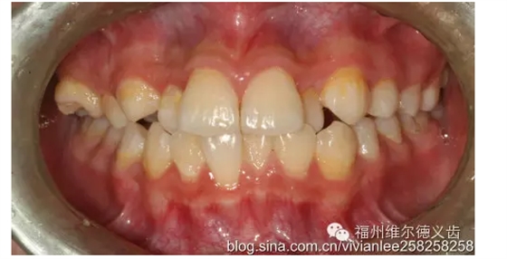 QQ圖片20150725100332.png QQ圖片20150725100332.png