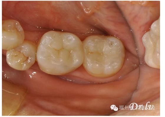 QQ圖片20150725100343.png QQ圖片20150725100343.png